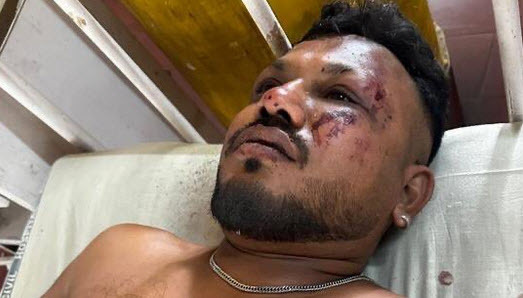 India plane crash survivor Vishwash Kumar Ramesh