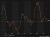 Korea PPI