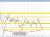 NZDUSD