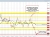 NZDUSD