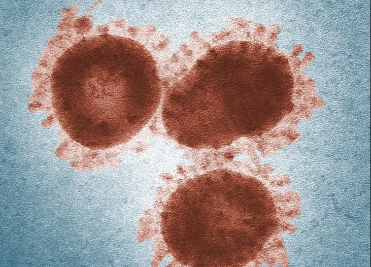 coronavirus